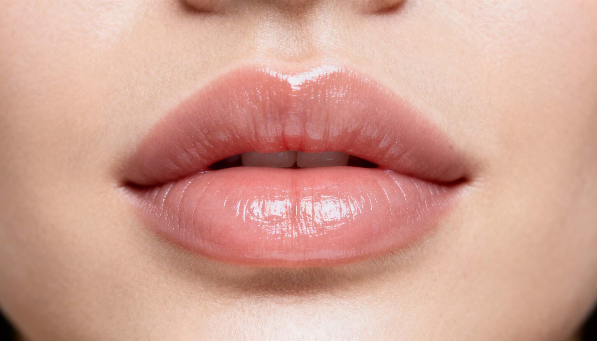 hacerme labios con acido hialuronico | hidratacion labial con acido hialuronico
