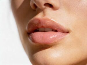 hidratacion labial en barcelona | hidratacion labial con acido hialuronico